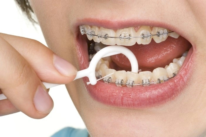 Flossing